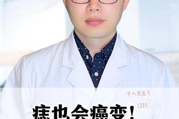 痣相多是癌症的征兆吗 因为痣癌变的人多吗