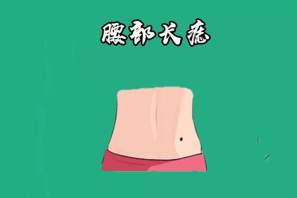 麻衣神相痣男(男子左腰部长痣图解)