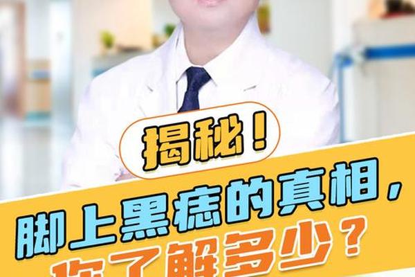 痣相解析脚上的痣 脚痣的位置与命运