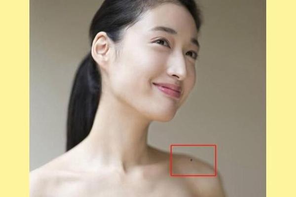 肩膀上长痣麻衣神相;肩膀有痣怎么说