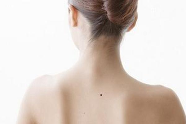 女人背后腰部痣相,女人后背腰部长痣好不好