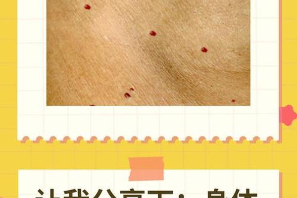 体相有红痣生于吉吗-女性胸上有红痣代表什么 体相有红痣生于吉吗-女性胸上有红痣代表什么