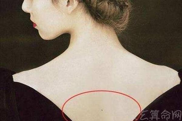 女子背部痣相最准图-女人后背有痣好吗