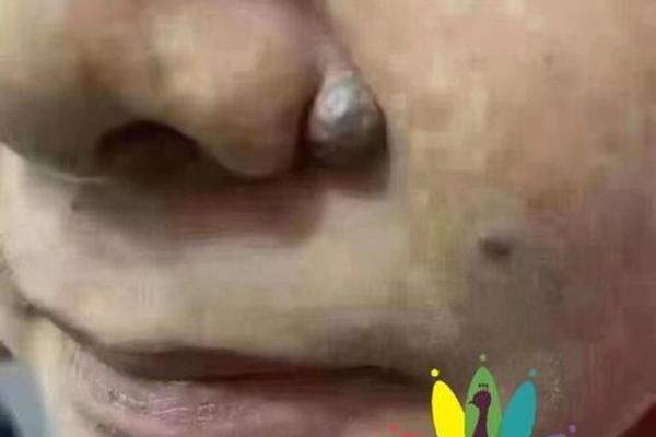 痣相漏财什么意思;什么叫漏财
