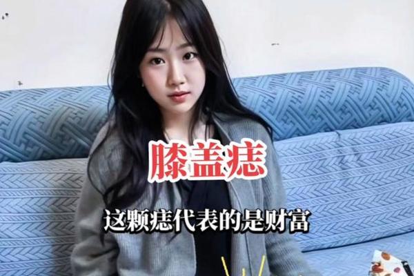 膝盖四大痣相解析(膝盖的关节详细图) 膝盖四大痣相解析(膝盖的关节详细图)