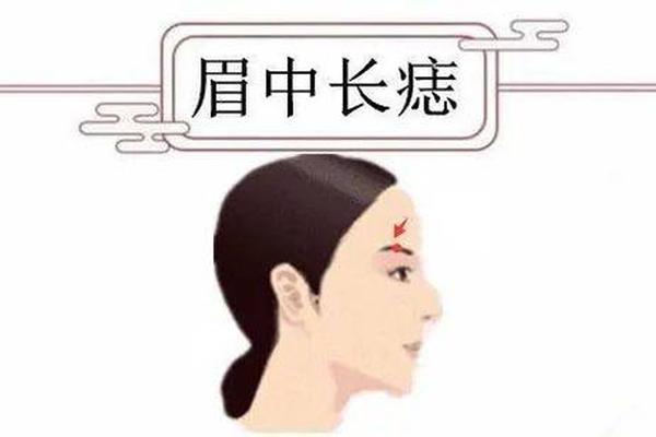 痣图相女人 女人下身有痣面相图解