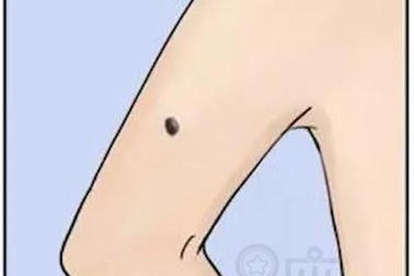 女人右手臂痣相_右手有痣图片大全 女人右手臂痣相_右手有痣图片大全