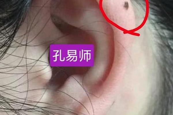 耳痣图相女生婚姻如何_耳痣的位置与命运图解女