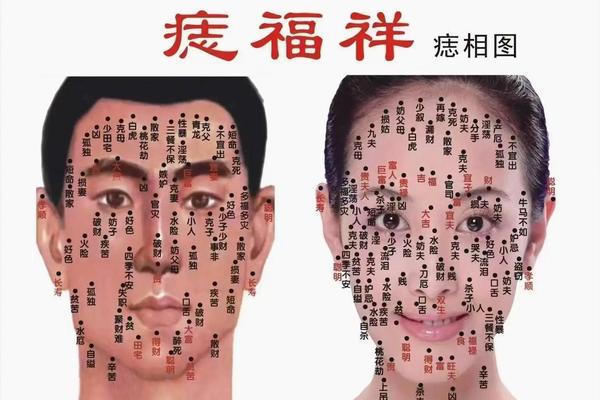 容县哪里有看痣相的—南宁哪里有点痣的地方