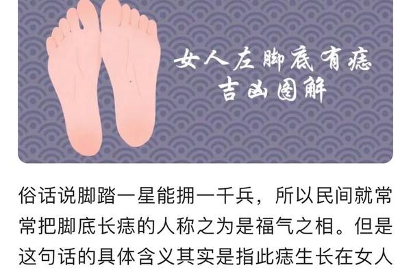 脚底看痣相_脚底的痣的位置与命运图解