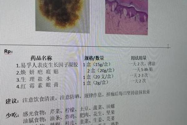 相城医院手术切痣怎么样;医院切痣需要住院吗 相城医院手术切痣怎么样;医院切痣需要住院吗
