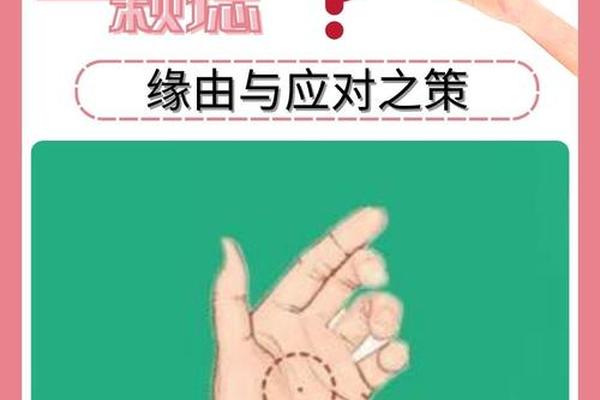 手掌有痣什么相(手掌突然长了一个痣)