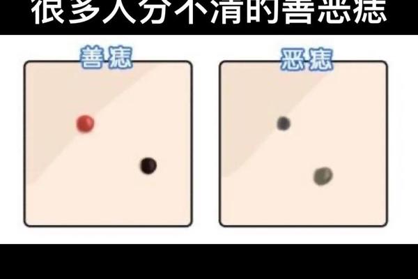 姚景元痣相_善痣和恶痣照片