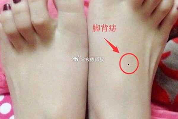 脚趾缝隙痣相_脚趾缝隙大命好吗