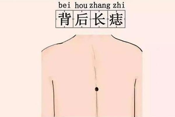 痣相身体背部 后背有痣代表什么 痣相身体背部 后背有痣代表什么