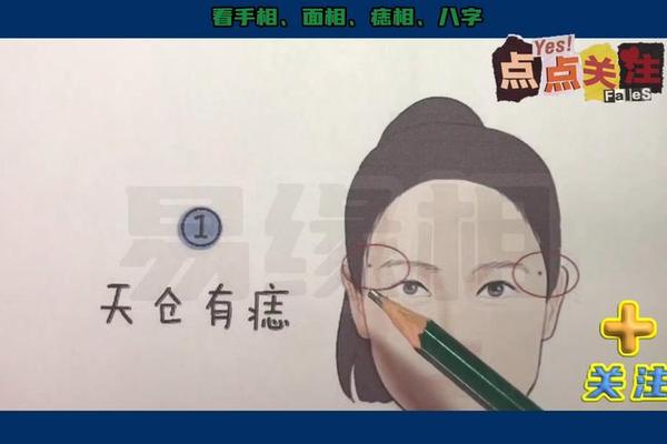 痣相迁移宫—天仓痣与迁移宫痣的区别