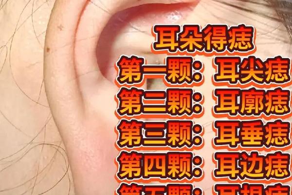 右耳后面有痣财相,右耳后面长痣代表什么