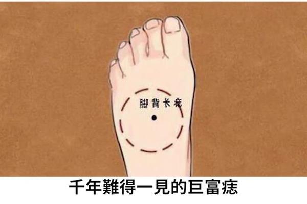 大脚趾 痣相_面相痣的图片大全