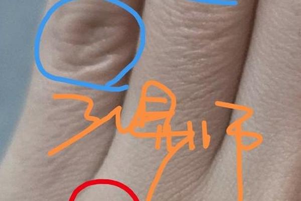 中指第二个关节痣相,大拇指第二关节有痣是什么意思