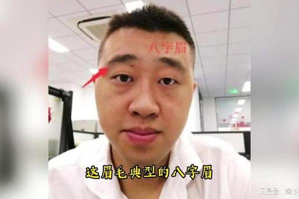 眉心有八字纹