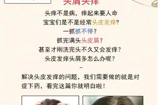 头皮和额头痣相_头皮发痒怎么办