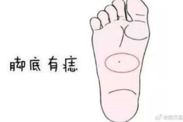 痣长在这里最有钱脚相,痣长在脚上哪个位置好