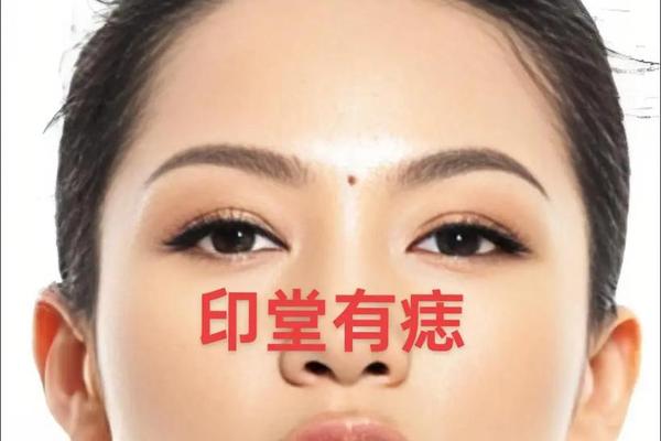 离婚痣相,二婚痣长在哪些地方