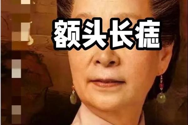 痣相女人贵妇人_女人额头贵妇人痣 痣相女人贵妇人_女人额头贵妇人痣