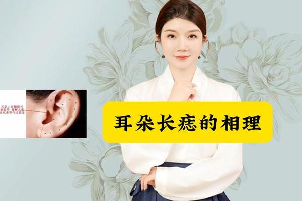痣相丧妻什么意思、耳朵后痣代表什么