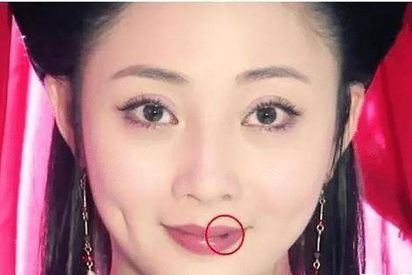 女孩嘴唇有痣是什么相—女孩子嘴唇上长痣 女孩嘴唇有痣是什么相—女孩子嘴唇上长痣