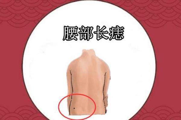 背部长痣相数-后背有痣命苦 背部长痣相数-后背有痣命苦