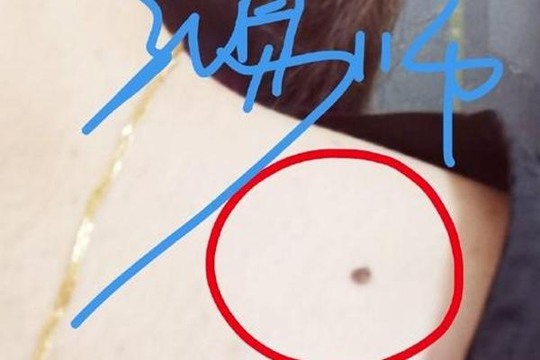 黄豆大的痣相_黄豆大凸起的痣是啥痣 黄豆大的痣相_黄豆大凸起的痣是啥痣