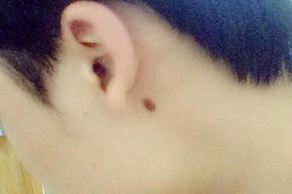 男人的手背痣相 耳朵上有痣的男人