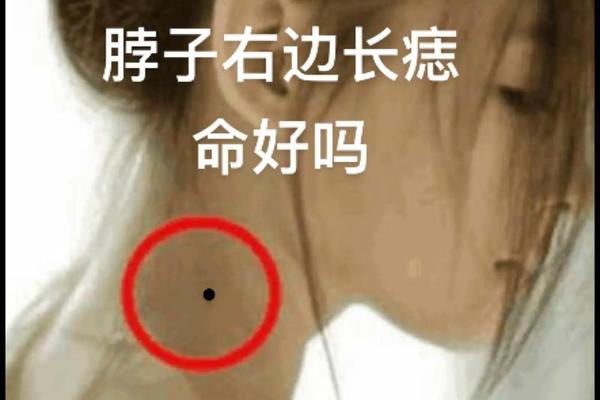 痣相男人脖子右侧的痣 脖子偏右侧有痣