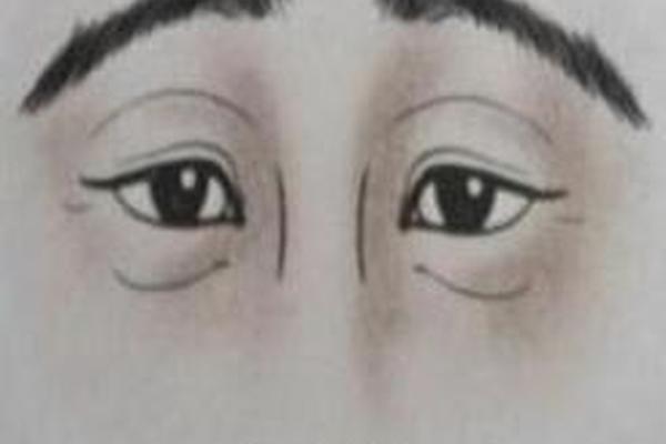 眉间有八字纹
