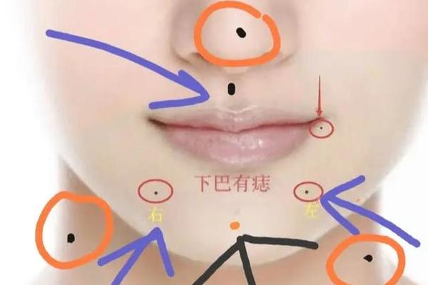 下鄂有痣相(下巴有痣图解)