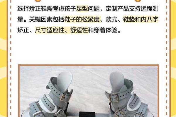矫正内八字 矫正内八字