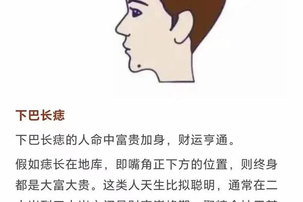 左下巴长痣有贵人相吗;下巴有痣必大富大贵