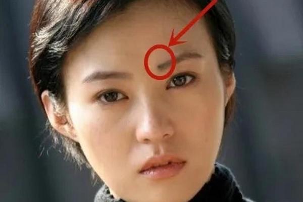 痣相不好的明星,脸上的哪些痣不能取