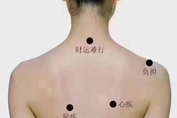 脖子后面有痣麻衣相解释-麻衣神相痣图解