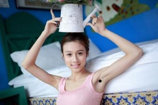 腋窝边痣相-右腋窝附近有痣但是在外侧