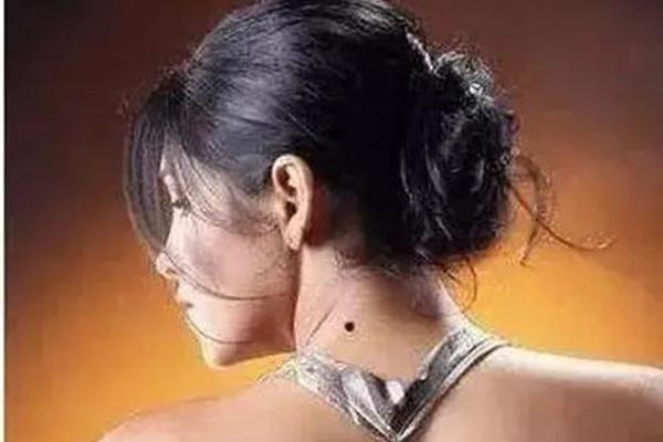 女人后颈痣相—脖子有痣代表什么