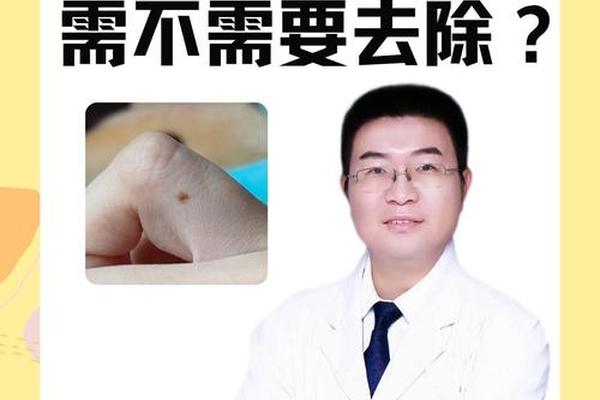 手相和痣相可信吗;面相痣相可信吗