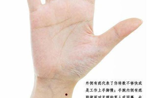 痣相女手碗有痣_女人手腕有痣全图解 痣相女手碗有痣_女人手腕有痣全图解