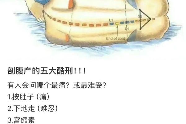 剖腹产生辰八字