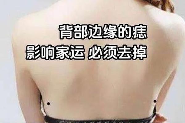 身体背后痣相、女人痣相图解
