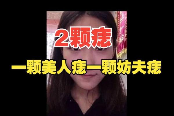 美相痣夫人公司_泪痣是美人痣吗