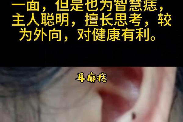 女相耳旁长颗痣_两边耳朵长痣代表什么 女相耳旁长颗痣_两边耳朵长痣代表什么