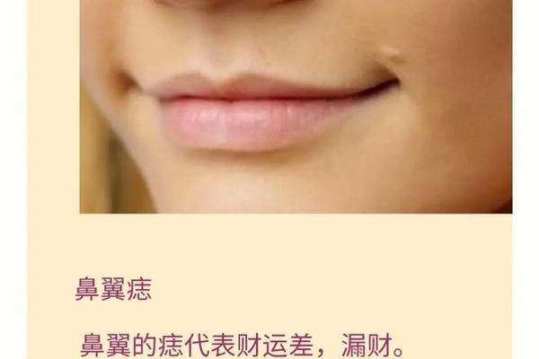 鼻子痣女相—女人鼻子有痣图解