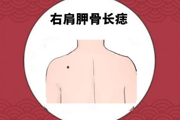 尾椎骨痣痣相大全、肩胛骨中间有颗痣